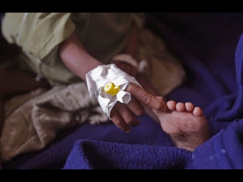 Baisse historique de la mortalité infantile, selon l'ONU, Africa News - Vidéo Baisse historique de la mortalite infantile selon lONU Africa News